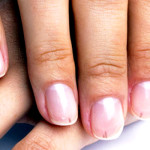 Черные полоски на ногтях: причины, лечение